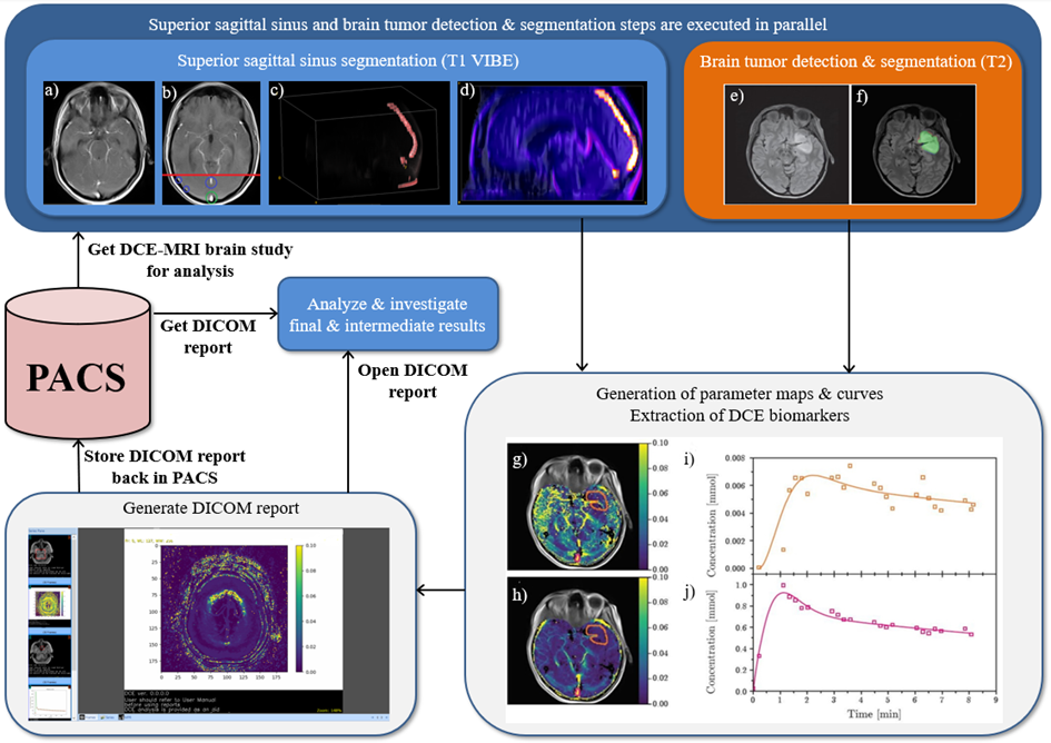 an image presenting the Automated Dynamic Contrast-Enhanced Magnetic Resonance Imagining analysis workflow with imaging biomarker extraction step