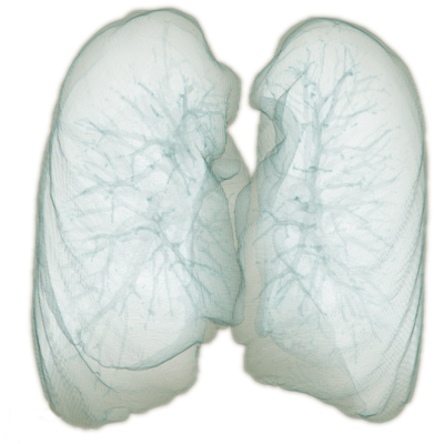 3D rendering of the lung segmentation produced with the algorithm