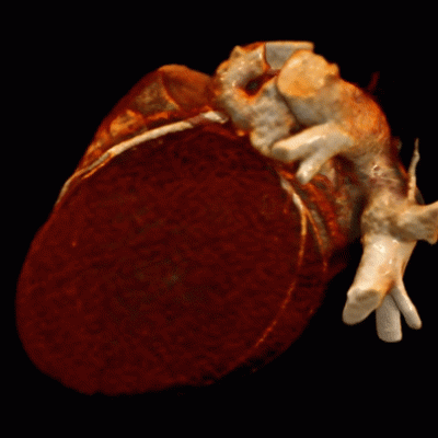 3d medical image visualisation prepared by Graylight Imaging