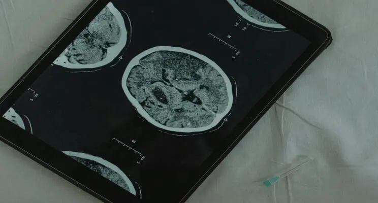 Pictured is a tablet with software to analyze medical images. The tablet shows a scan from medical imaging. The photo was used as the cover of a post on the regulations of software as a medical device.